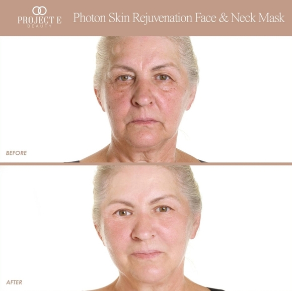 Project E Photon Mask - Picture 9 of 16